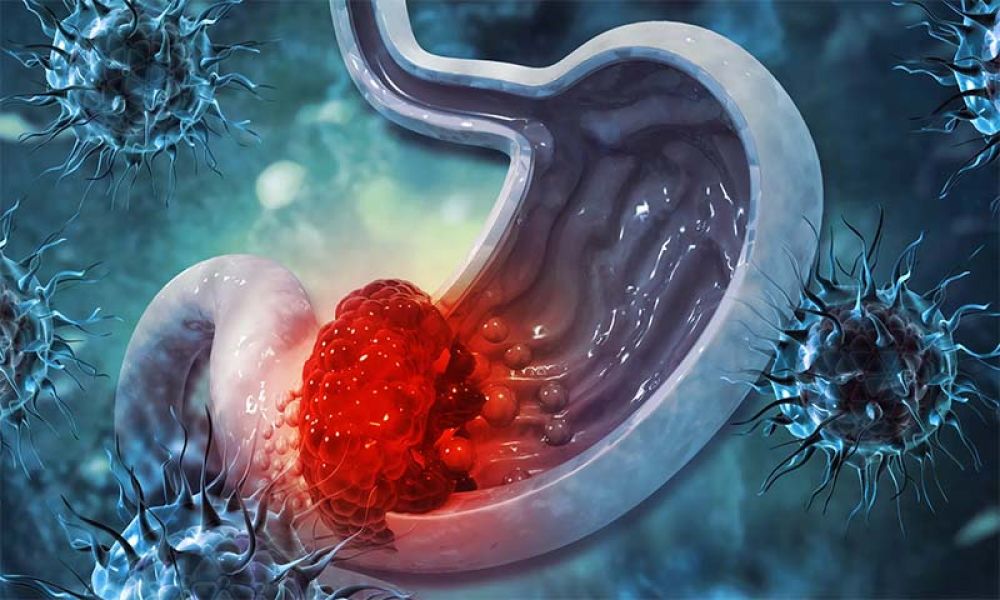 Bacteria in Tummy accurately predict your age